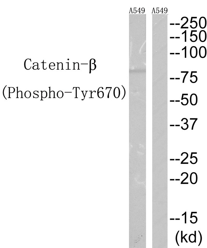 Anti-Phospho-CTNNB1 (Tyr670) Polyclonal Antibody