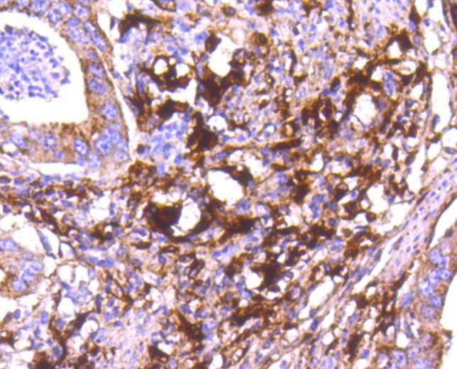Anti-Cathepsin D Antibody (4I539)
