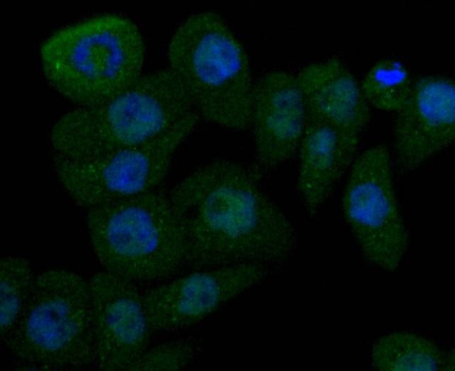 Anti-Cathepsin D Antibody (4I539)