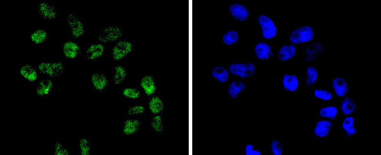 Anti-SMARCA4 Antibody (3I277)