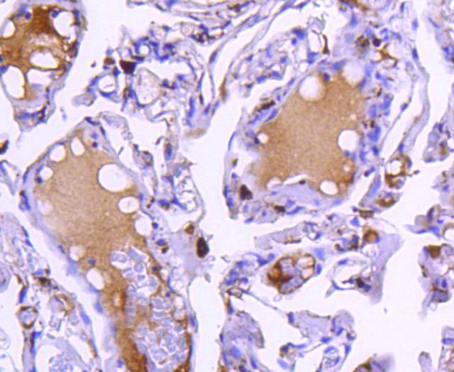 Anti-Cathepsin D Antibody (4I539)