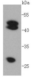 Anti-Cathepsin D Antibody (4I539)