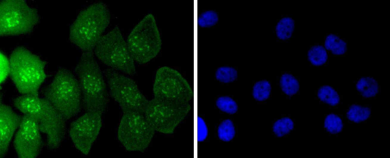 Anti-Caspase-14 Antibody (3A777)