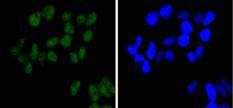 Anti-SMARCA4 Antibody (3I277)