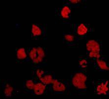Anti-Breast cancer-overexpressed gene 1 protein Antibody (1N989)