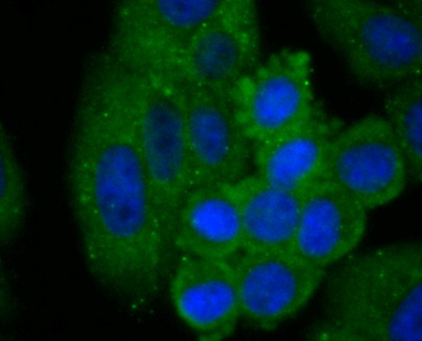 Anti-C14orf93 Antibody (8U54)