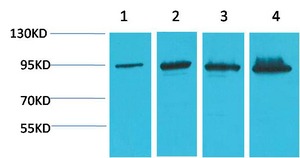 Anti-CTNNB1 Antibody (2B924)