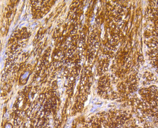 Anti-Caldesmon Antibody (6J397)