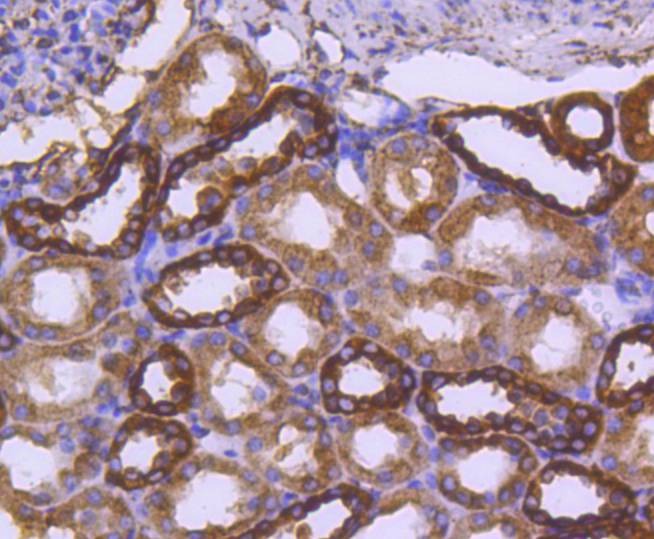 Anti-Calreticulin Antibody (8J512)