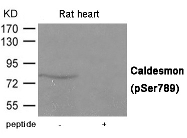 Anti-Phospho-Caldesmon (Ser789) Polyclonal Antibody