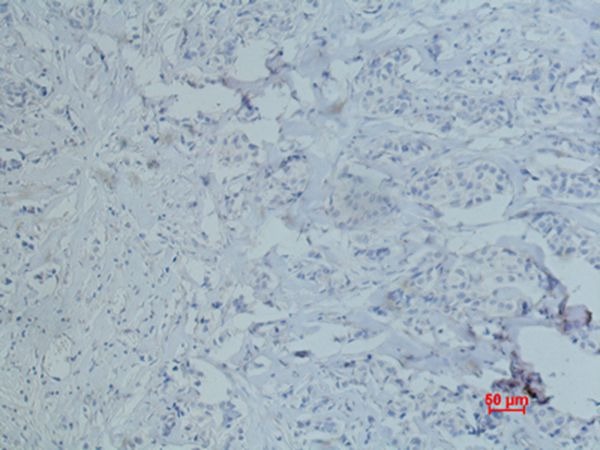 Anti-Neprilysin/CD10 Antibody (4F847)