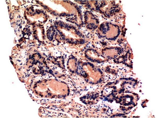 Anti-Caspase-3 Antibody (1S354)