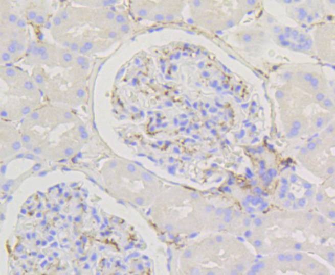 Anti-Caldesmon Antibody (6J397)