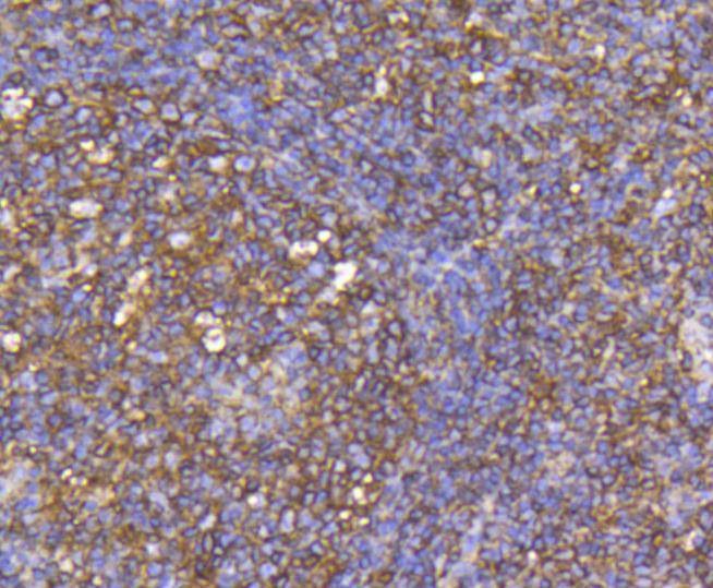 Anti-CCR7 Antibody (8C836)
