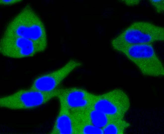Anti-CALM1 Antibody (9G576)