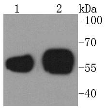 Anti-Calreticulin Antibody (8J512)
