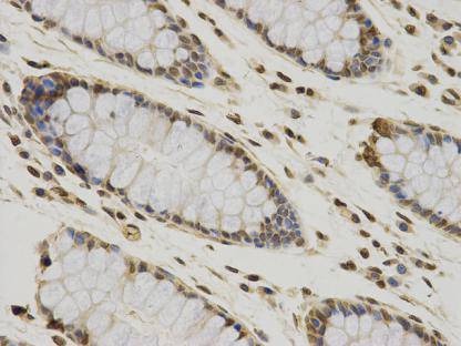 Anti-CCDC111 Antibody (9Q490)