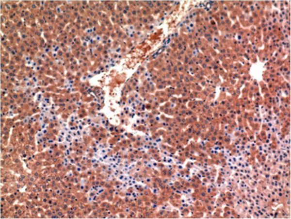 Anti-Caspase-3 Antibody (1S354)