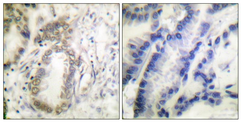 Anti-Phospho-C/EBP alpha (Ser21) Polyclonal Antibody