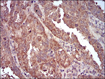 Anti-CAV2 Antibody (8Z468)