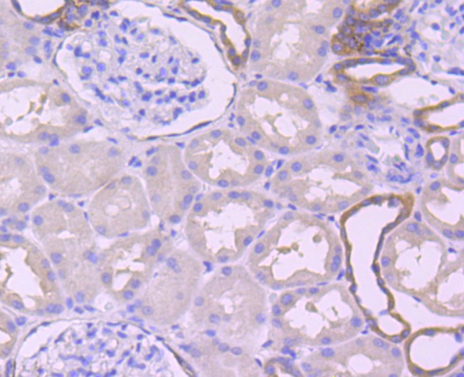Anti-CAPN2 Antibody (6Z187)