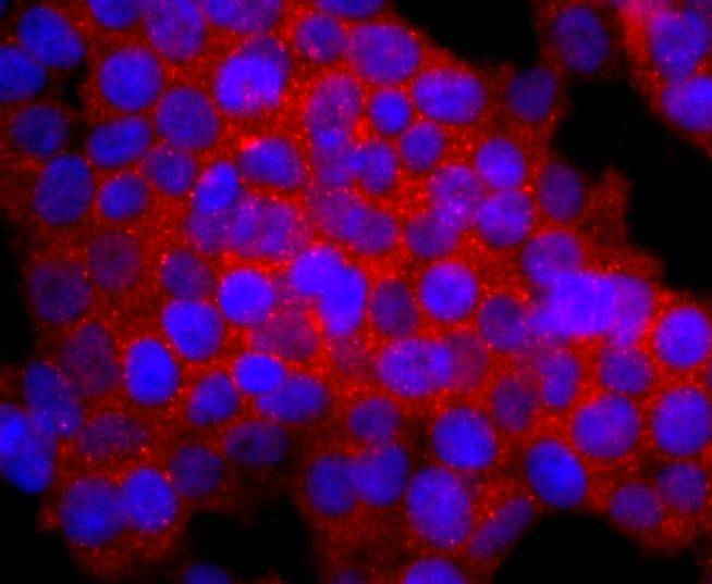 Anti-Calbindin Antibody (5F708)