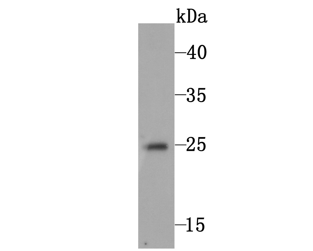 Anti-C10orf58 Antibody (6V65)