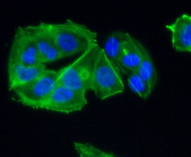 Anti-CCR7 Antibody (8C836)