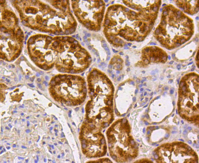Anti-CASP2 Antibody (8H206)