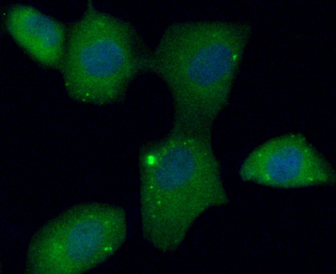 Anti-C10orf58 Antibody (6V65)