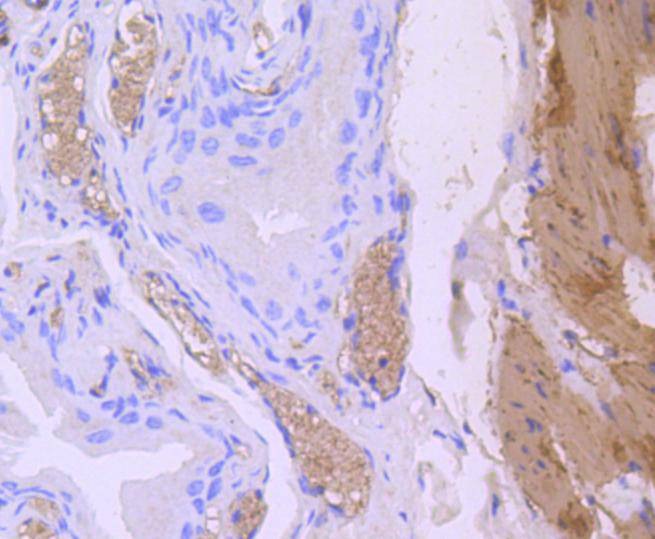 Anti-CNN1 Antibody (5Y848)