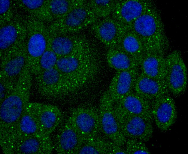 Anti-CAPN2 Antibody (6Z187)