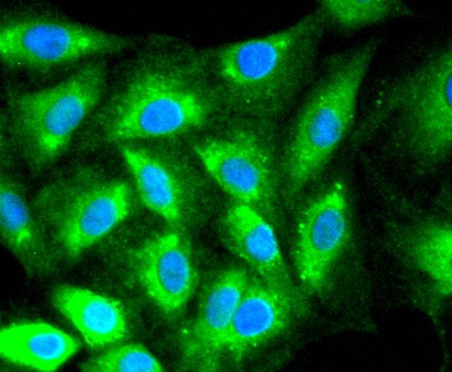 Anti-Calreticulin Antibody (8J512)