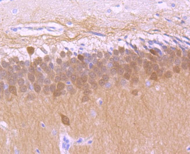 Anti-Calbindin Antibody (5F708)