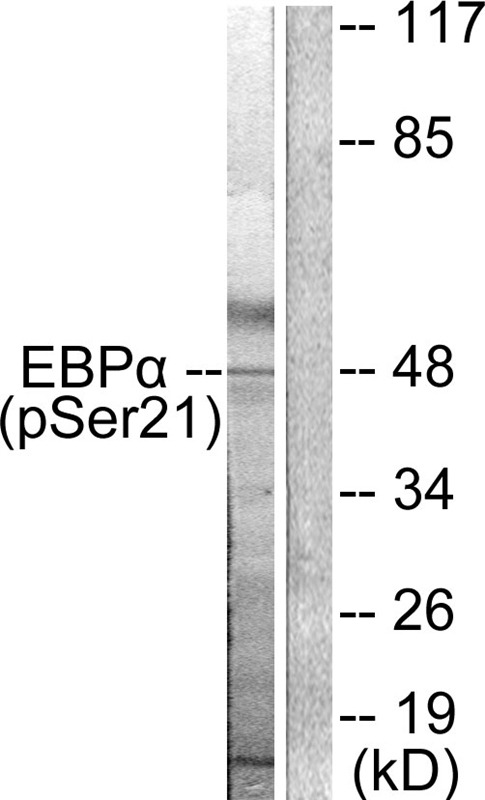 Anti-Phospho-C/EBP alpha (Ser21) Polyclonal Antibody