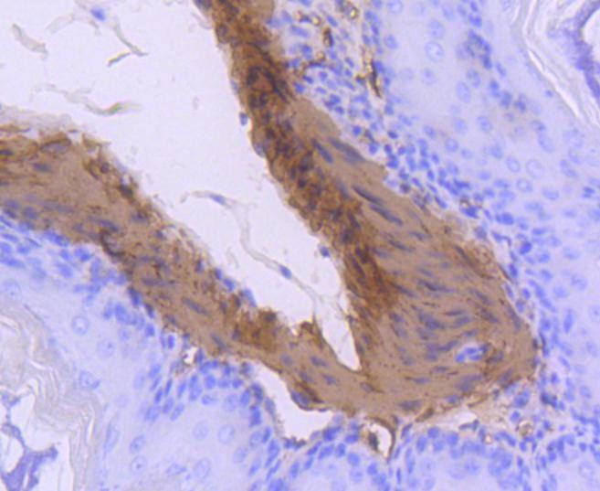 Anti-CNN1 Antibody (5Y848)
