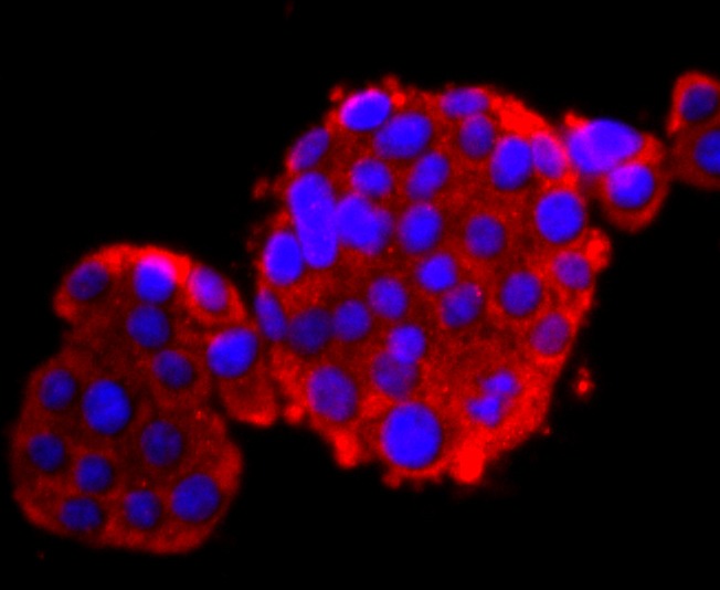 Anti-Calbindin Antibody (5F708)