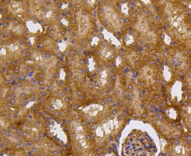 Anti-CASP2 Antibody (8H206)