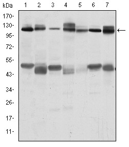 Anti-CBL Antibody (8B374)