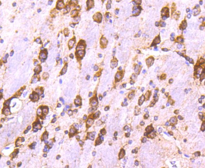 Anti-Calreticulin Antibody (8J512)