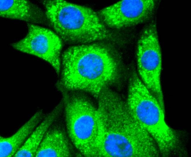 Anti-Calreticulin Antibody (8J512)