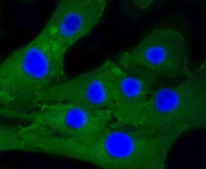 Anti-Caldesmon Antibody (6J397)