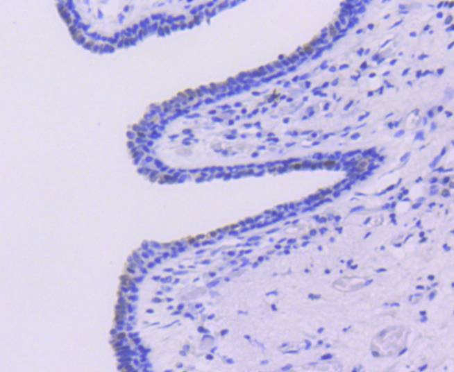 Anti-Caspase-6 Antibody (5J689)