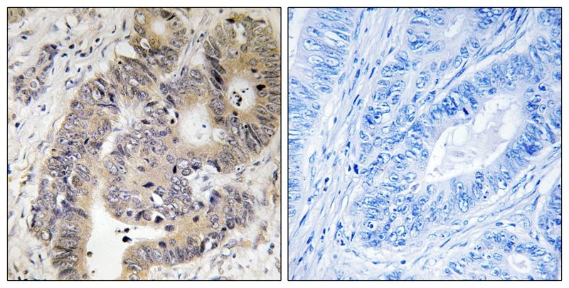 Anti-Phospho-CAD (Thr456) Polyclonal Antibody