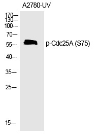 Anti-Phospho-CDC25A (Ser75) Polyclonal Antibody 2