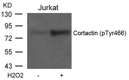 Anti-Phospho-Cortactin (Tyr466) Polyclonal Antibody