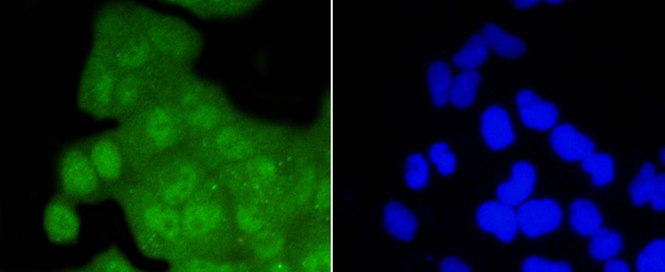 Anti-CDK2 Antibody (3L593)