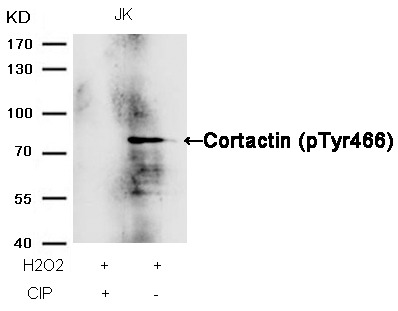 Anti-Phospho-Cortactin (Tyr466) Polyclonal Antibody