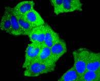 Anti-Cortactin Antibody (9I917)