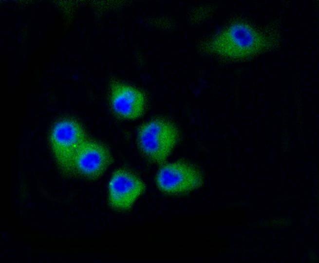 Anti-CDK2 Antibody (3L593)